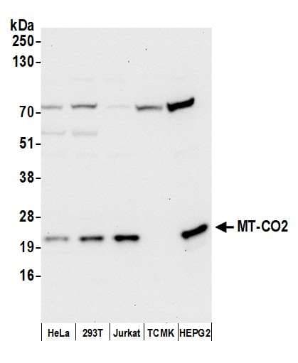 Polyclonal Rabbit anti-Human MT-CO2 Antibody (aa125-175, WB)