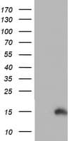 PFDN6 / HKE2 Antibody (clone OTI4E10)