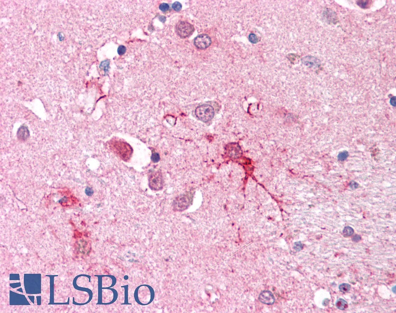 IHC-plus™ SLC1A4 / ASCT1 Antibody (C-Terminus)