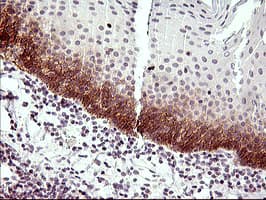 IL6R / IL6 Receptor Antibody (clone OTI2F4)