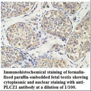 PLCZ1 Antibody (aa322-572)