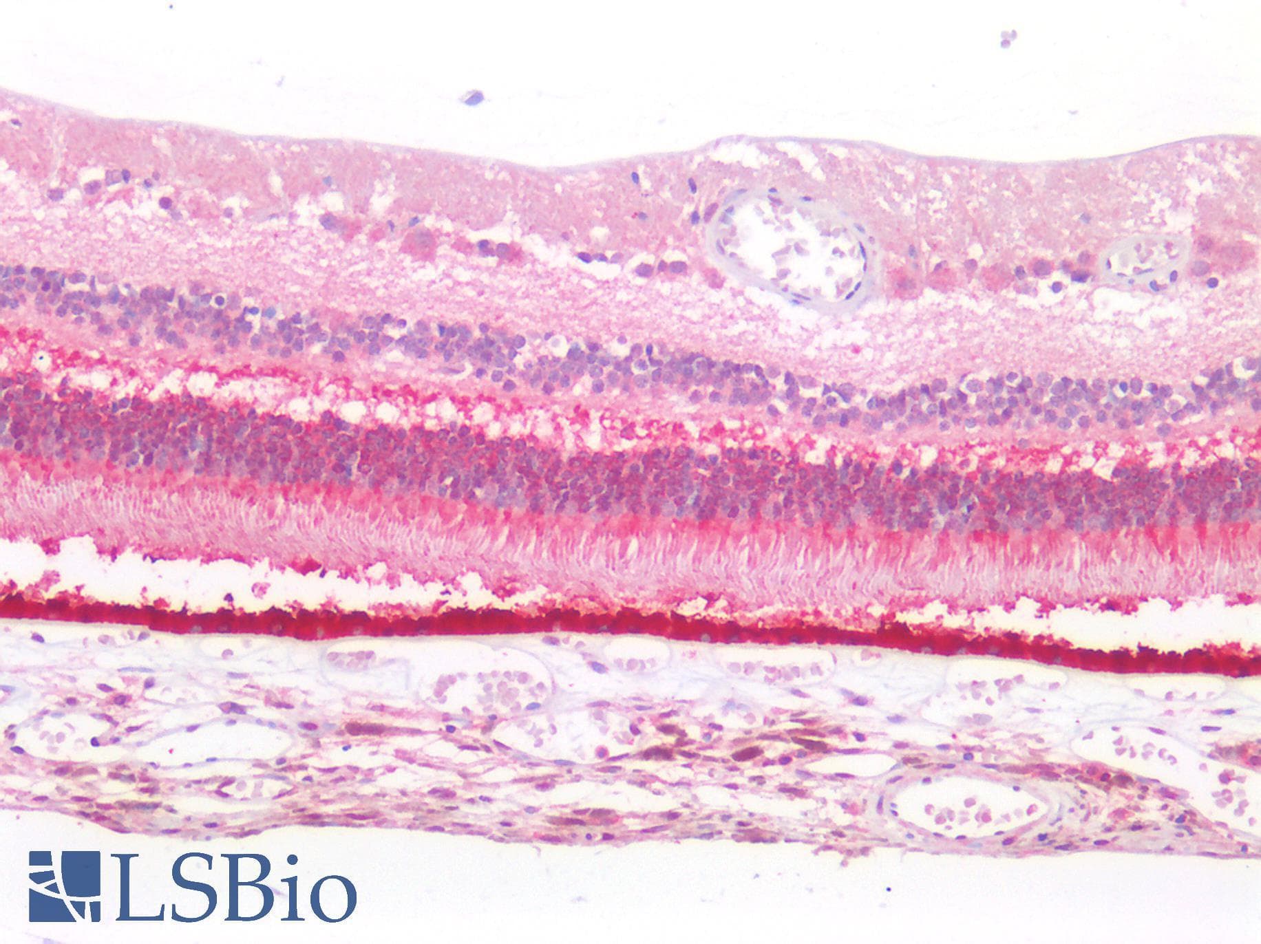 PathPlus™ RPE65 Antibody
