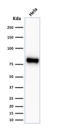 PathPlus™ CTNNB1 / Beta Catenin Antibody (clone CTNNB1/2030R)