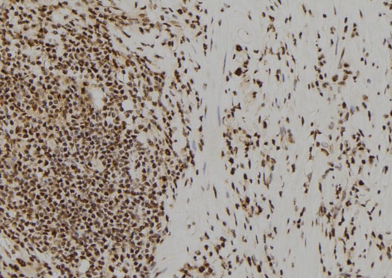 UROD Antibody