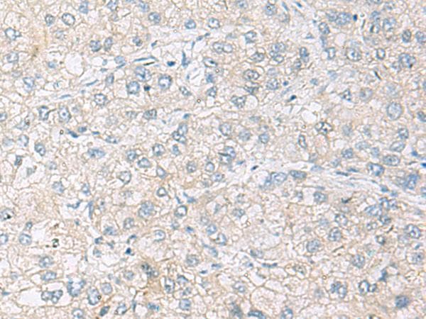 Polyclonal Rabbit anti-Human FARP2 / FRG Antibody (IHC)