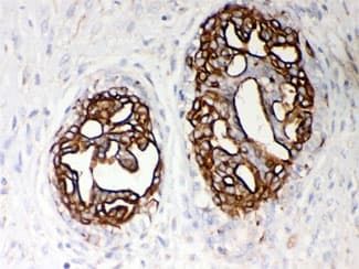 Polyclonal Rabbit anti-Human Pyruvate Kinase Antibody (IHC, WB)