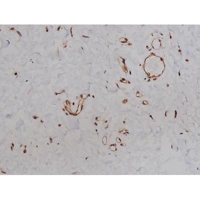 MAPT / Tau Antibody (phospho-Ser396)