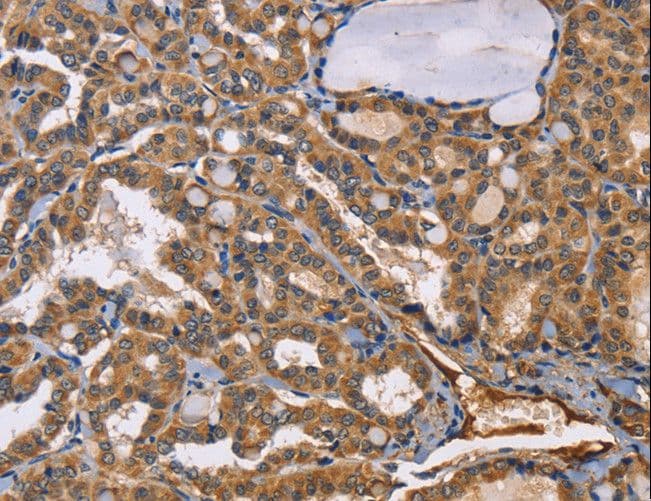 EPHB6 / EPH Receptor B6 Antibody
