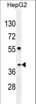 Polyclonal Rabbit anti-Human SEC13 Antibody (aa72-100, WB)
