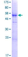 Human ZCRB1 Protein (Recombinant GST)