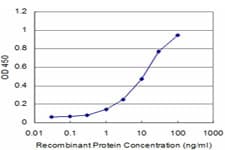 Monoclonal Mouse anti-Human PROX1 Antibody (clone 1E7, IF, WB)