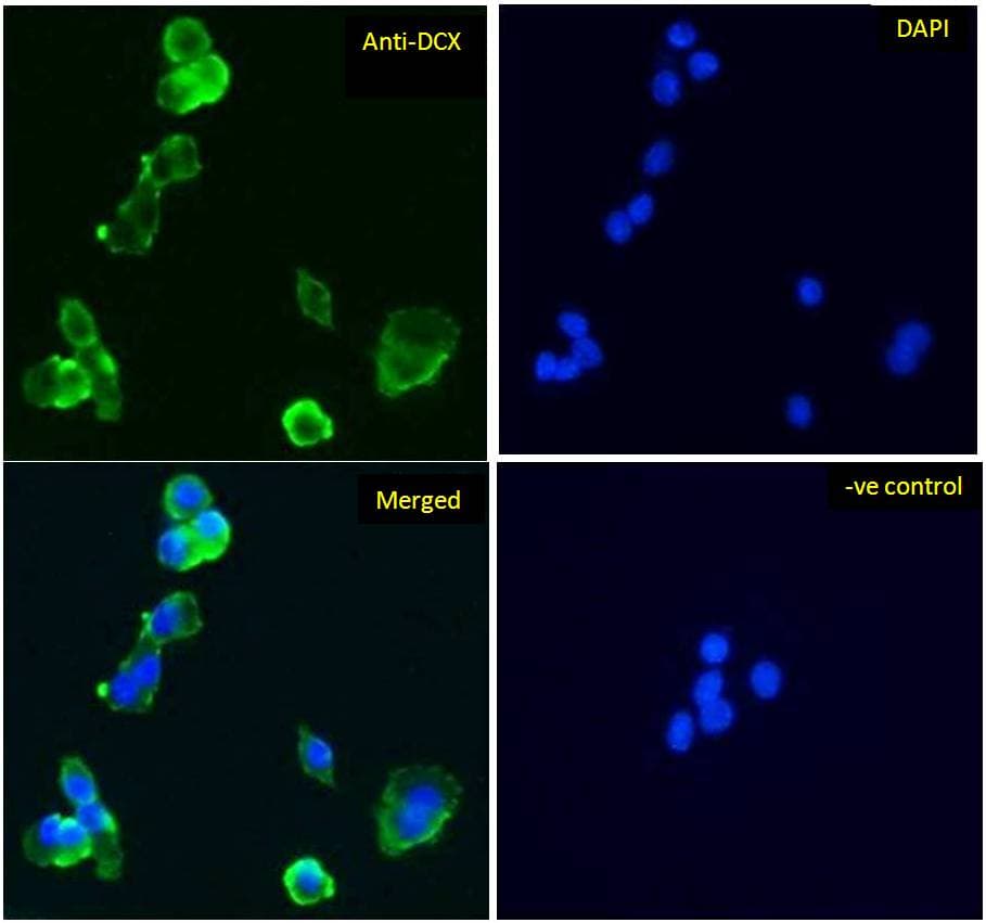 DCX / Doublecortin Antibody (aa232-242)