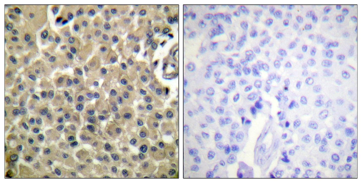 EMA / MUC1 Antibody (Ab-1243)