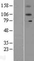 Human IL12RB2 Protein (Over-Expression Lysate Myc-DDK (Flag))