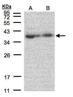 Polyclonal Rabbit anti-Human MRPL3 Antibody (aa286-348, WB)