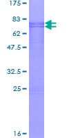 Human CABYR Protein (Recombinant GST)