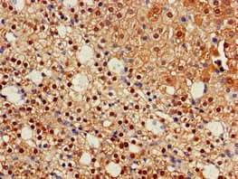 IDH1 / IDH Antibody