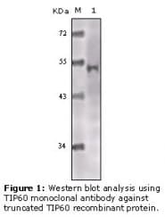 Monoclonal Mouse anti-Human KAT5 / TIP60 Antibody (clone 3F9G7, IHC, WB)