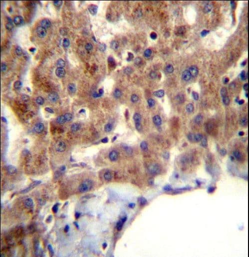 Polyclonal Rabbit anti-Human MBNL2 Antibody (aa261-290, IHC, WB)
