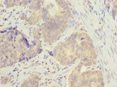 MSTO1 / MST Antibody