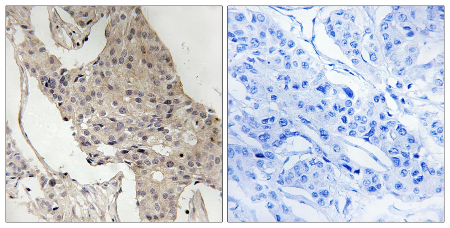 GAB2 Antibody (phospho-Ser623)