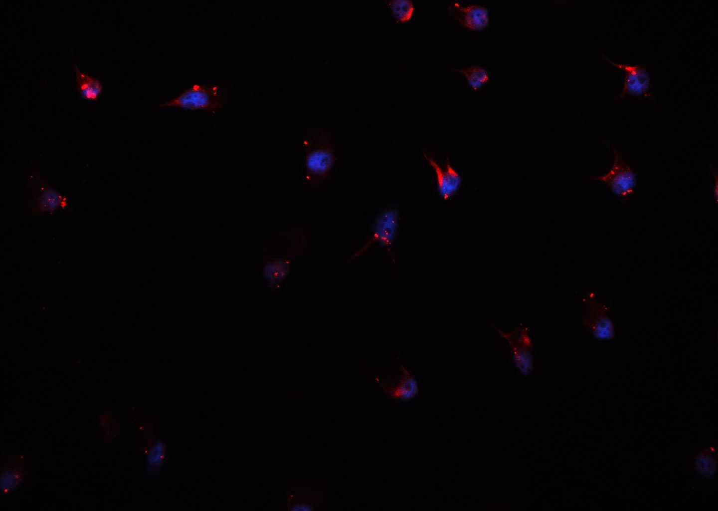 CSTB / Cystatin B / Stefin B Antibody