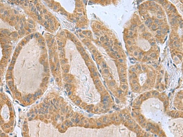 Polyclonal Rabbit anti-Human SLC30A6 Antibody (IHC)