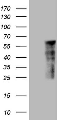 LRRC6 Antibody (clone OTI2A2)
