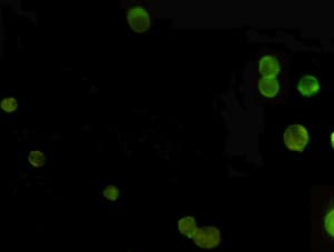 Monoclonal Mouse anti-Human AMACR / P504S Antibody (WB)