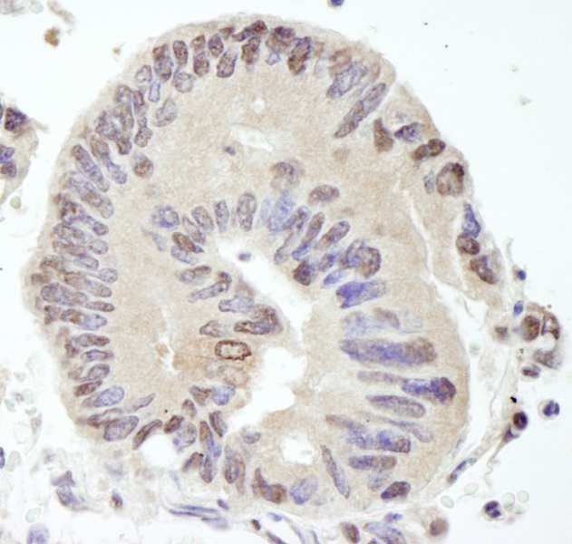 USP10 Antibody (aa50-100)