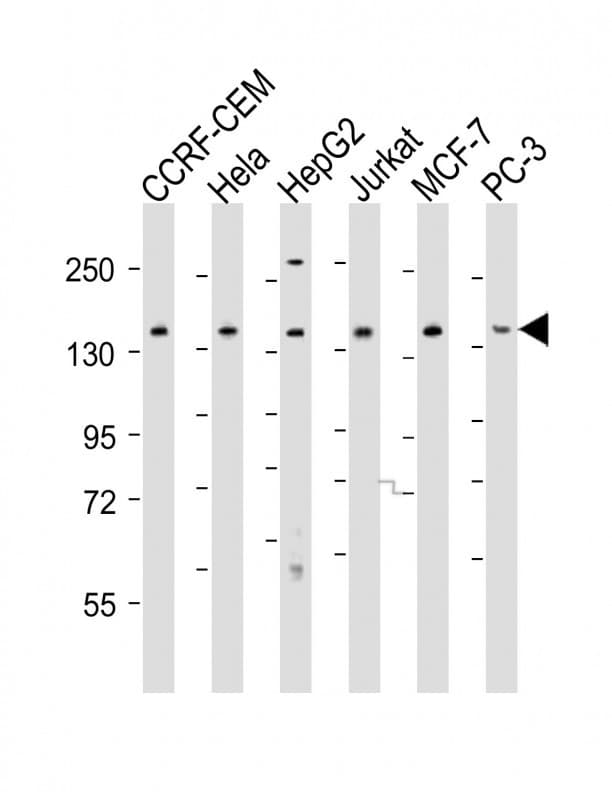 PLCG1 Antibody (aa456-488)