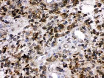 UCHL1 / PGP9.5 Antibody