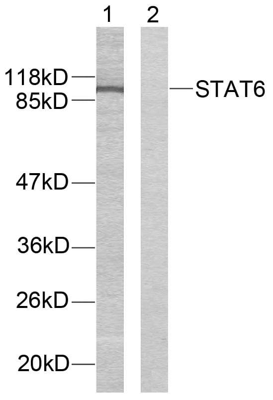 STAT6 Antibody (p641)