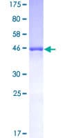 Human HSPB1 / HSP27 Protein (Recombinant GST)