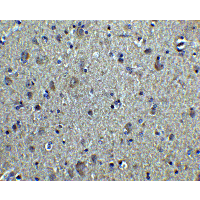 IHC-plus™ TUBA1A / Tubulin Alpha 1a Antibody