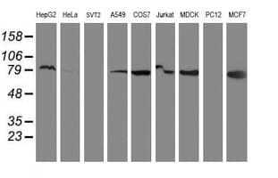 RPN1 / Ribophorin I Antibody (clone OTI3H3)