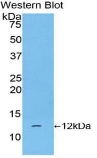 CGA / hCG Alpha Antibody (aa25-116)