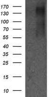 Monoclonal Mouse anti-Human ERBB2 / HER2 Antibody (clone OTI6F3, Carrier-free, aa676-1255, IHC, IF, WB)