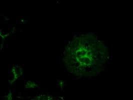 PathPlus™ KRT8 / CK8 / Cytokeratin 8 Antibody (clone 4D12)