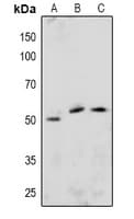 Polyclonal Rabbit anti-Human ETS1 / ETS-1 Antibody (IHC, WB)