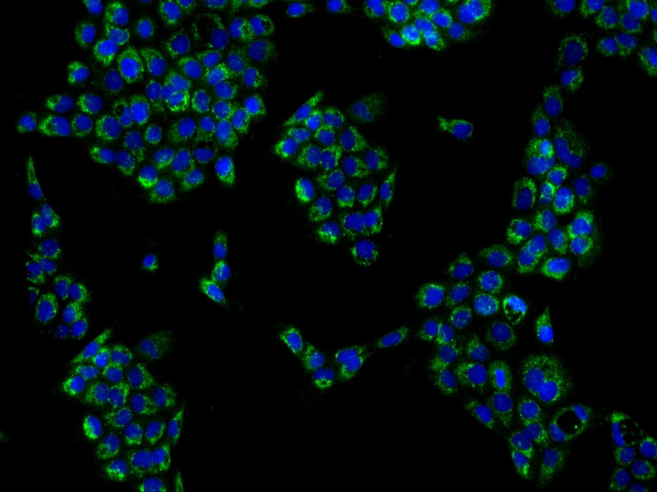 KHDC1 / C6orf148 Antibody