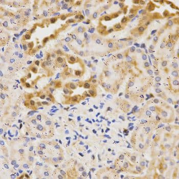 Polyclonal Rabbit anti-Human APG5 / ATG5 Antibody (IHC)