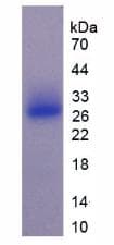 Mouse USAG1 / SOSTDC1 Protein (Recombinant His-T7)