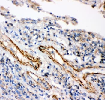 IKBKB / IKK2 / IKK Beta Antibody