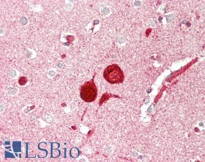 ABCG1 Antibody (aa79-312)