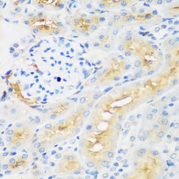 Polyclonal Rabbit anti-Human PROCR / EPCR Antibody (IHC, WB)