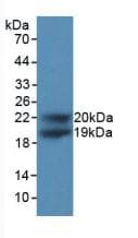 CDKN1A / WAF1 / p21 Antibody (aa1-164)