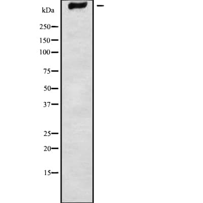 Polyclonal Rabbit anti-Human ADGRV1 / GPR98 Antibody (WB)