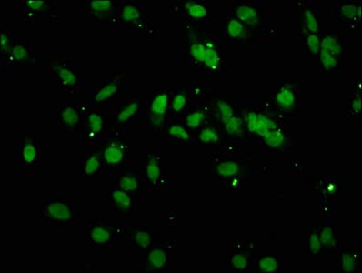 Polyclonal Rabbit anti-Human HIST1H3A Antibody (IHC, IF)