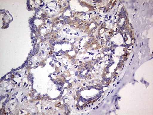Monoclonal Mouse anti-Human PKM2 Antibody (clone 11B11, IHC, WB)
